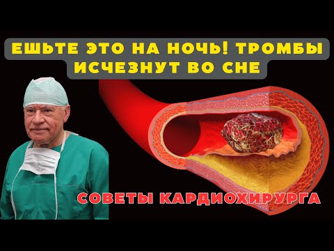 Видео: ЕМ ЭТО КАЖДЫЙ ДЕНЬ И ЖИВУ ДОЛГО! Секреты Чистых Сосудов от Лео Бокерии