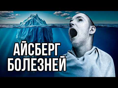 Видео: Айсберг ЖУТКИХ болезней