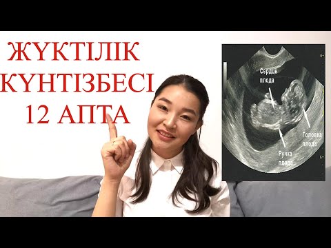 Видео: ЖҮКТІЛІК КҮНТІЗБЕСІ 12 АПТА//КАЛЕНДАРЬ БЕРЕМЕННОСТИ