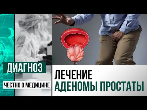 Видео: Аденома простаты: что это такое, и как её сегодня лечат хирурги | Диагноз