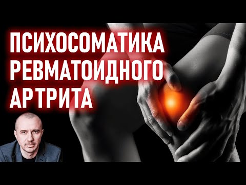 Видео: Какие ситуации приводят к ревматоидному артриту. Серопозитивный и серонегативный артрит