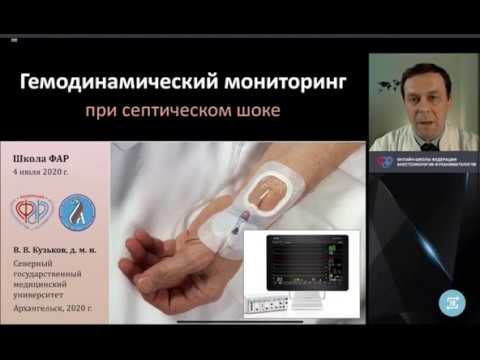 Видео: Гемодинамический мониторинг при септическом шоке