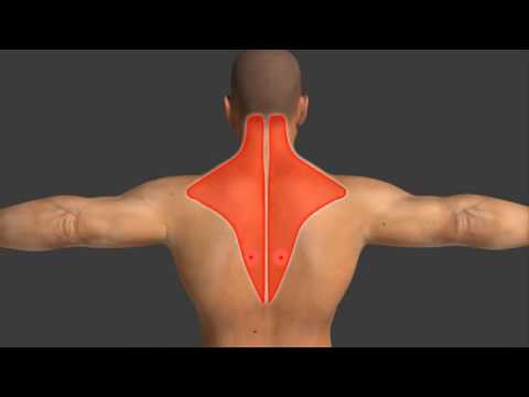 Видео: Триггерная точка лечение