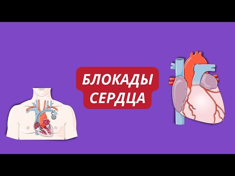 Видео: Блокады сердца 🫀 виды, с чем связаны, как распознать на ЭКГ?
