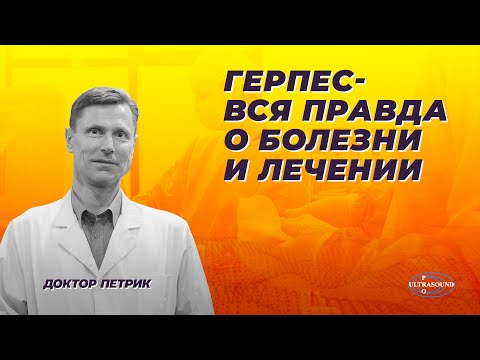 Видео: Герпес - вся правда о болезни и лечении.