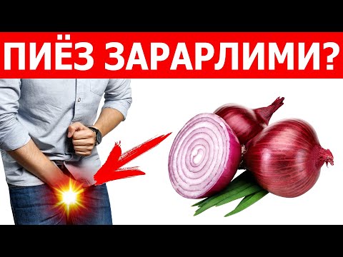 Видео: СИЗ ИСТЕЪМОЛ ҚИЛАЁТГАН ПИЁЗ АСЛИДА ОРГАНИЗМГА ҚАНДАЙ ТАЪСИР ҚИЛИШИНИ БИЛАСИЗМИ?