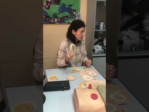 Видео: Семинар «Особенности применения конвексных пластин»