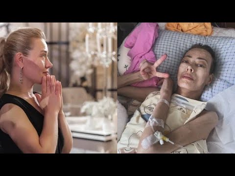 Видео: Побоялась лечить рак