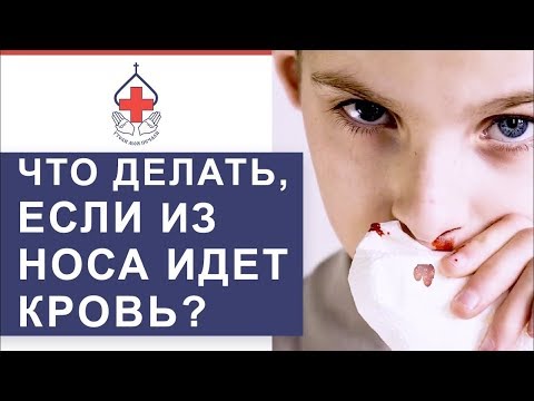 Видео: 👃 Носовые кровотечения: причины, первая помощь, лечение. Носовые кровотечения причины. 12+