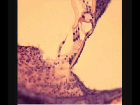 Видео: ВНУТРЕННЕЕ УХО. СПИРАЛЬНЫЙ ОРГАН. Internal ear. Гистологическое строение