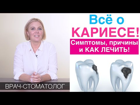 Видео: Кариес - симптомы, лечение кариеса, причины появления. Как лечить кариес (без сверления)