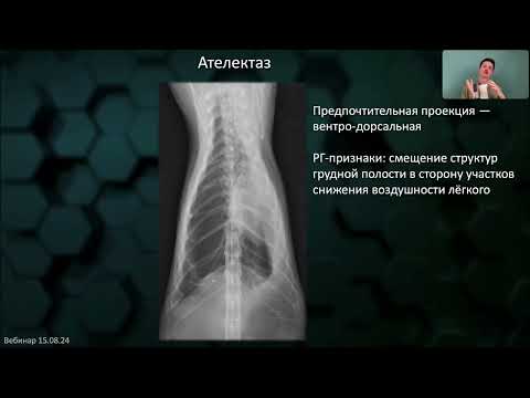Видео: SIMAKOV | Ошибки интерпретации рентгенограмм. Диагноз с одного снимка | Бесплатный вебинар
