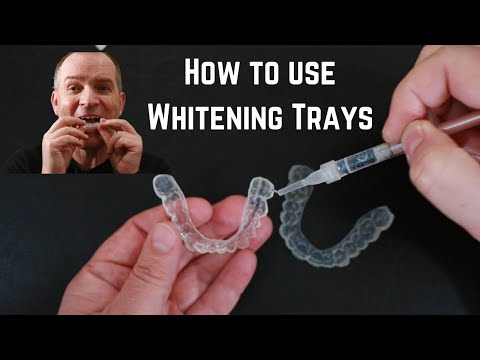 Видео: Как использовать индивидуально подобранные каппы для отбеливания зубов.