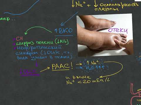 Видео: Нефрология - Гипонатриемия - Урок 11