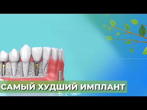 Видео: Какие имплантаты не советуют☘️