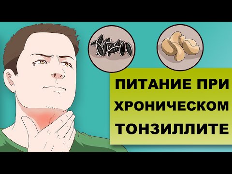 Видео: СЕМЕЧКИ И ОРЕХИ ПРИ ХРОНИЧЕСКОМ ТОНЗИЛЛИТЕ - вред или польза?