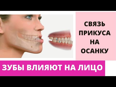 Видео: КАК ЗУБЫ ВЛИЯЮТ НА ЛИЦО. Ирэн Влади