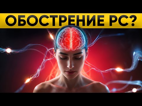 Видео: Как лечить ОБОСТРЕНИЕ при Рассеянном Склерозе