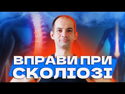 Видео: Вправи при сколіозі, Зміцнюємо м'язи спини, Кращий комплекс вправ