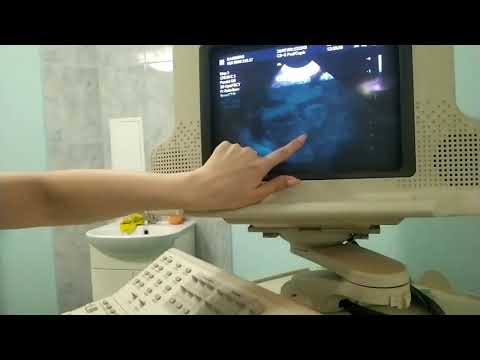 Видео: Узи ТОИ́-ТЕРЬЕРА🐾