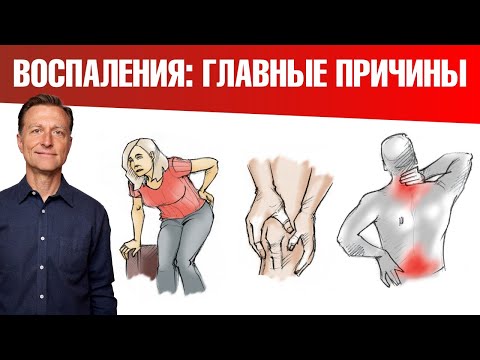 Видео: 13 главных причин воспаления. Как уменьшить воспаление в организме🤔