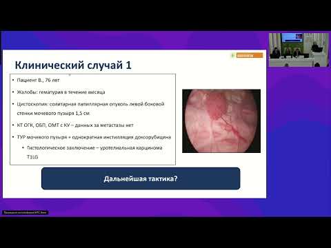 Видео: Немышечно-инвазивный РМП высокого риска: разбор клинических случаев с экспертами