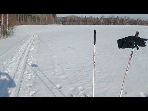 Видео: Замена тазобедренных суставов ( ТБС ) , два года спустя. Мой опыт.
