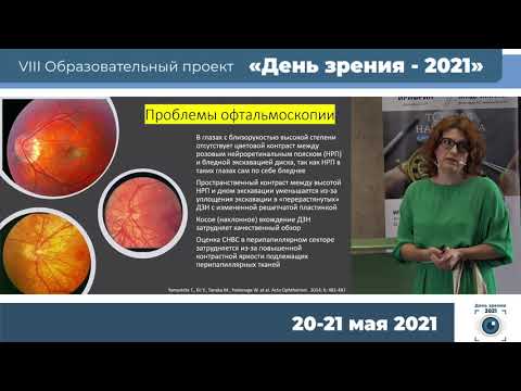 Видео: Зверева О.Г. - Дифференциально диагностические признаки начальной глаукомы с миопией высокой степени