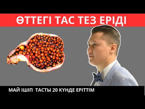 Видео: Өттегі тасты 20 күнде түсірді. Өттегі тасты қалай түсіруге болады? Өт тасын түсіру жолдары