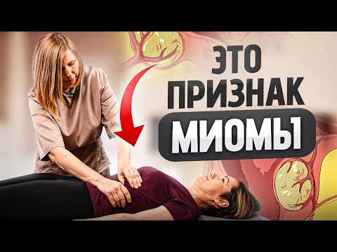 Видео: Как по внешним признакам понять, что у Вас миома матки?
