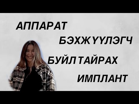 Видео: Шүдний талаар бүх юмаа ярьлаа 🙂