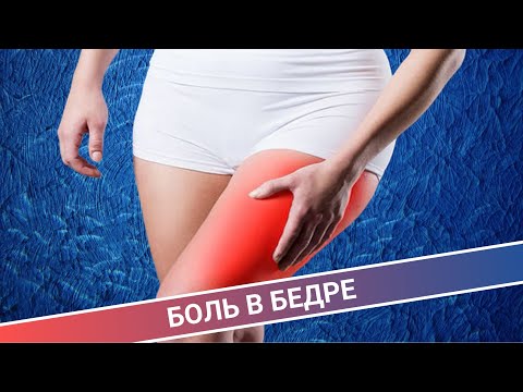 Видео: БОЛЬ В ОБЛАСТИ БЕДРА (ЛАМПАСНЫЙ СИНДРОМ)