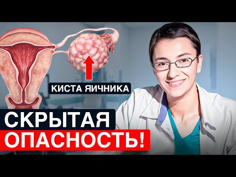 Видео: КИСТА ЯИЧНИКА. Как оценить влияние на способность к зачатию и онкориски.