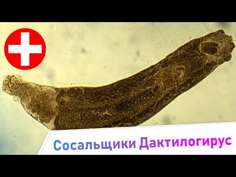 Видео: Сосальщики Дактилогирус - Симптомы и Лечение. Жизненный цикл паразита