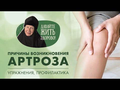 Видео: Артроз обоих коленных суставов. Упражнения. «Давайте жить здорово!»