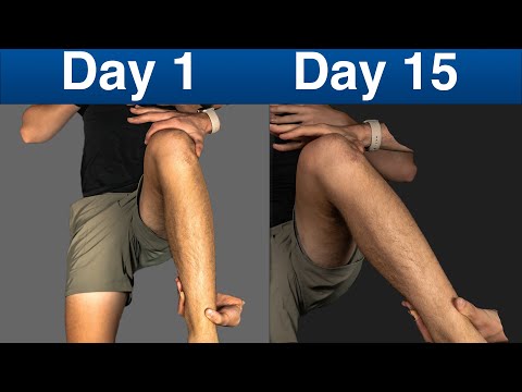 Видео: Исправьте внутреннюю ротацию бедра (БЫСТРО)