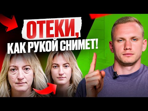 Видео: Как избавиться от застоя лимфы? Реальные причины лимфатических отеков