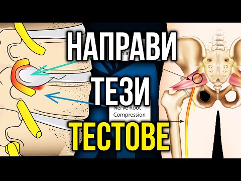 Видео: ДИСКОВА ХЕРНИЯ или ПИРИФОРМИС СИНДРОМ - Тествайте сами!