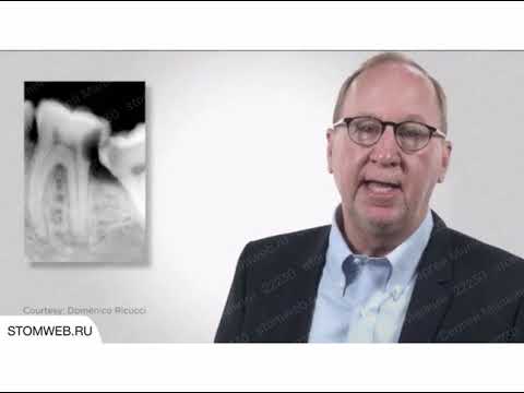 Видео: Тест чувствительности пульпы