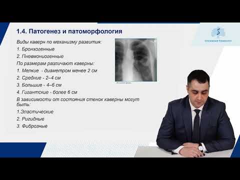 Видео: 5 Кавернозный туберкулез легких