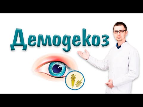 Видео: Демодекоз и клещ демодекс