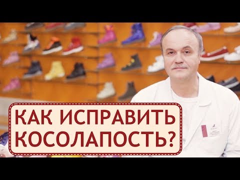 Видео: 👟  Лечение косолапости с помощью ортопедической обуви. Косолапость лечение. Персей. 12+
