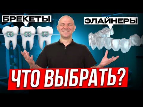 Видео: Что лучше: брекеты или элайнеры? Совет стоматолога с 12-летним стажем