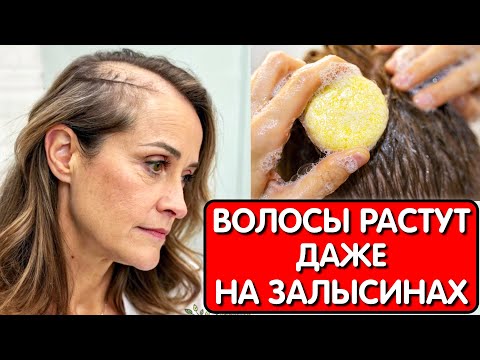 Видео: Эта маска СПАСЛА ОТ ВЫПАДЕНИЯ ВОЛОС ! Добавила СРЕДСТВО В ШАМПУНЬ и Волосы растут как сумасшедшие