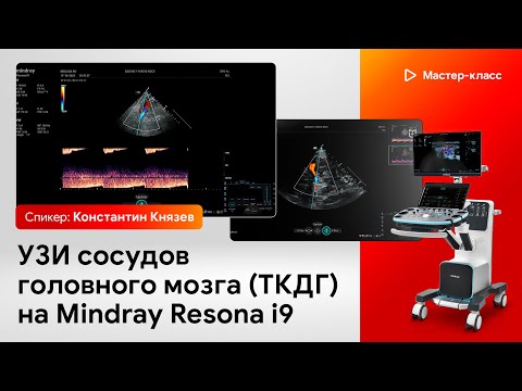 Видео: УЗИ сосудов головного мозга (ТКДГ) на Mindray Resona i9