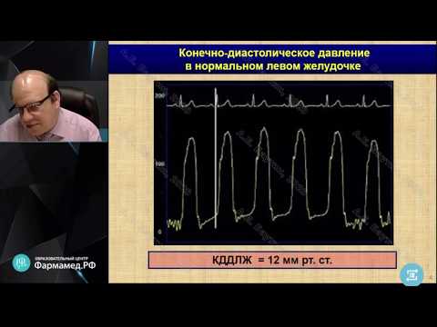 Видео: Острая сердечная недостаточность