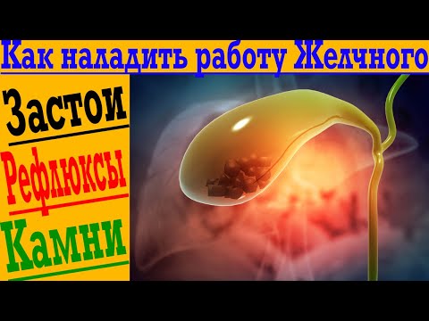 Видео: Как наладить работу Желчного пузыря! Рефлюксы, застой, камни и многое другое!