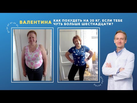 Видео: Валентина. Как похудеть на 20 кг, если тебе чуть больше шестнадцати?
