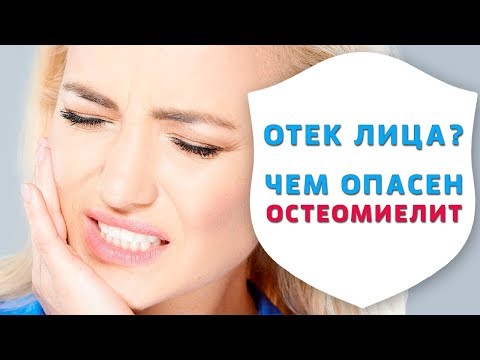 Видео: Отек лица, остеомиелит или периостит? Срочно к хирургу-стоматологу | Истории пациентов | Дентал ТВ
