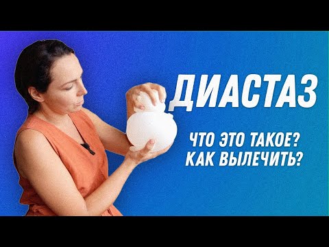 Видео: Диастаз что это? Как определить? Как лечить? | Остеопат Марина Просветина